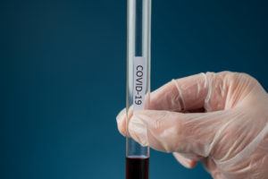 Hand of a doctor wearing protecting glove holding a glass test tube with blood sample and a Covid 19 sign on it.