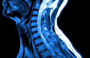 MRI 2 300x193.jpg